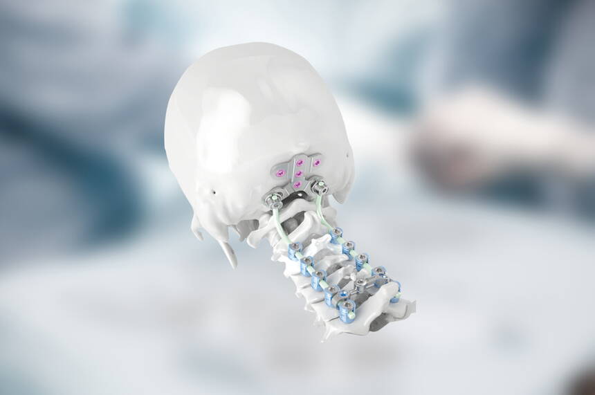 verticale_cervical.jpg